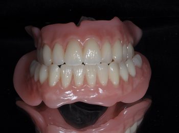 Full upper and Lower dentures (2)