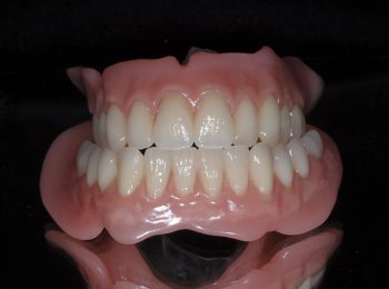 Full upper and Lower dentures (3)