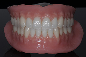 Denture Services
