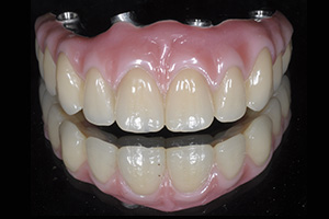 Implant Services