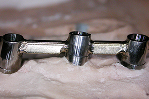 Laser welding