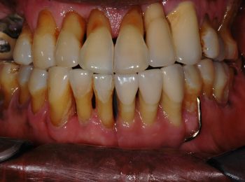 ????????????????????????????????????