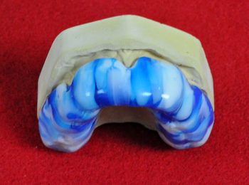 mouth guard 5