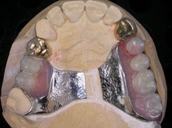 Laser Welding - Trevor Brooker 001