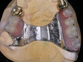 Laser Welding - Trevor Brooker 002