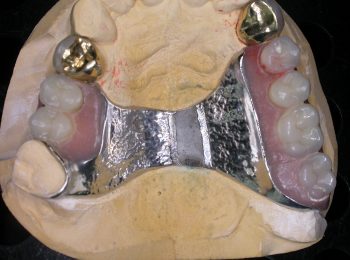 Laser Welding - Trevor Brooker 004