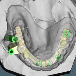 Digital Dentistry