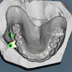 Digital Dentistry