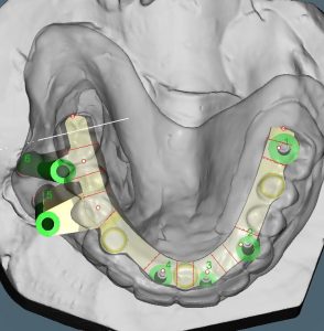 Digital Dentistry
