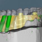 Digital Dentistry