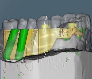 Digital Dentistry