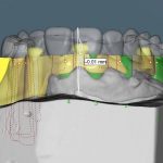 Digital Dentistry