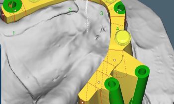 Digital Dentistry